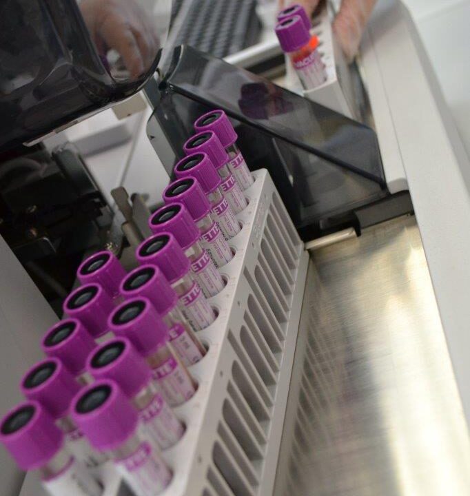 Tūkstančiai atsakymų iš kraujo lašo: naujos galimybės išsaugoti jūsų sveikatą